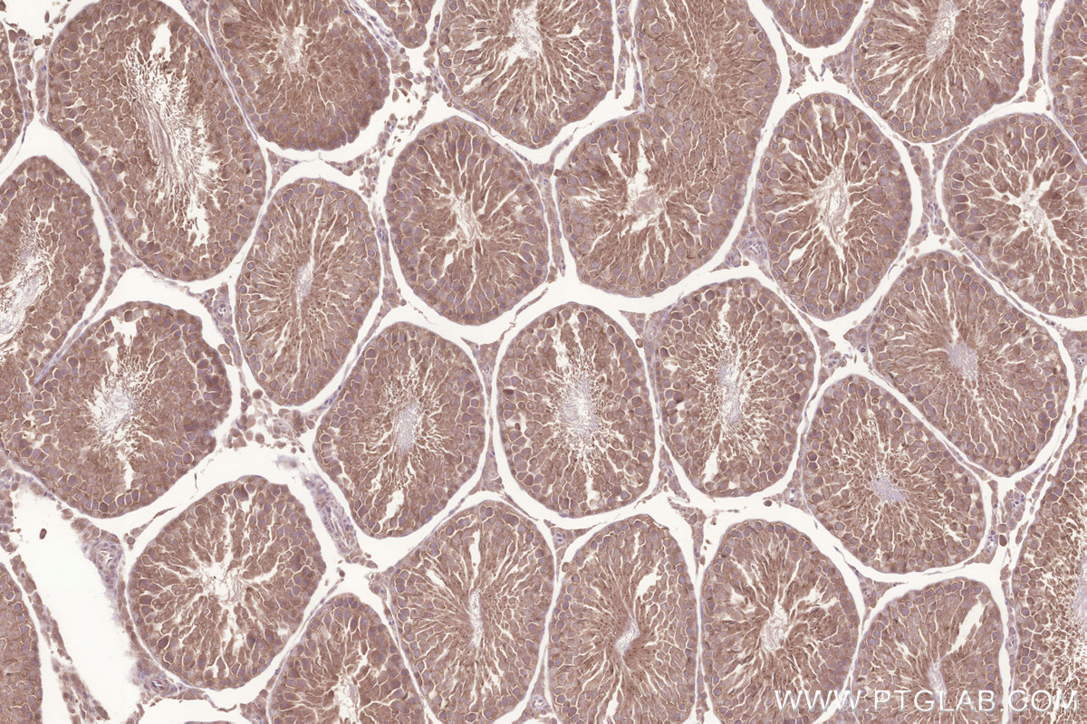 IHC staining of rat testis using 26782-1-AP IHC staining of rat testis using 26782-1-AP