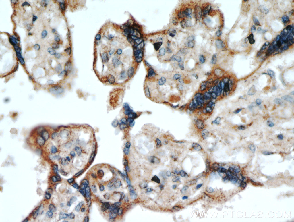 IHC staining of human placenta using 20718-1-AP