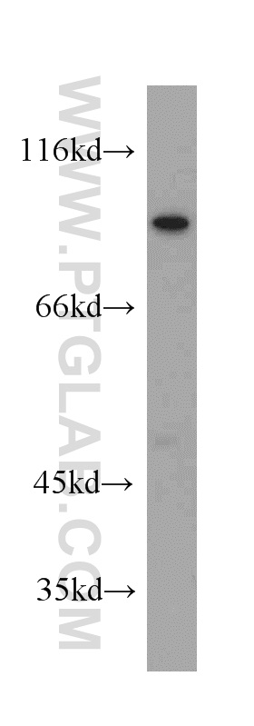 WB analysis of mouse brain using 20718-1-AP