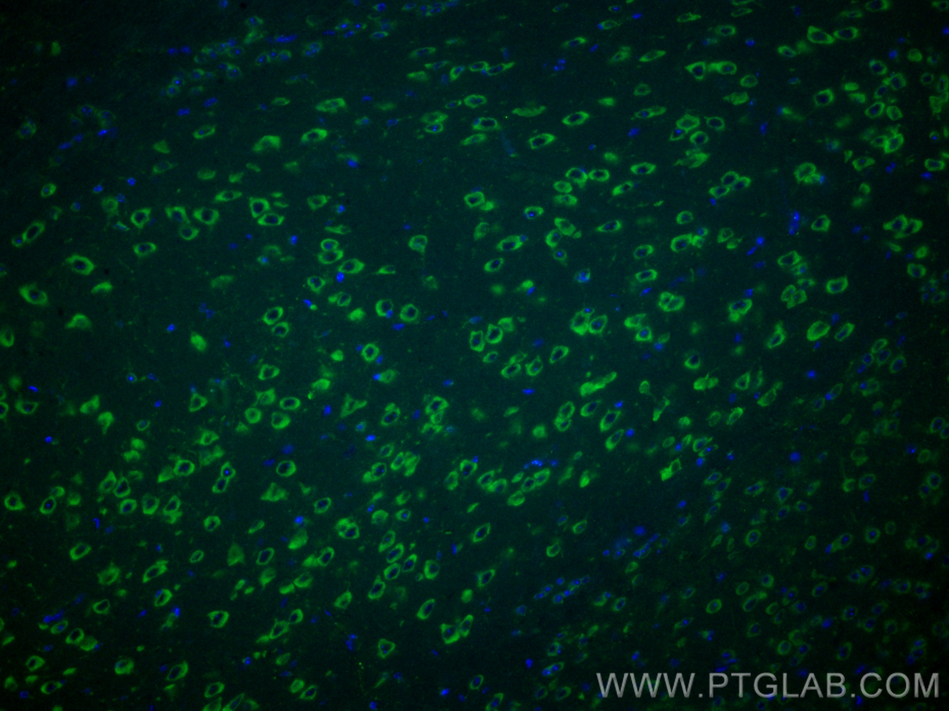 IF Staining of mouse brain using CL488-20718