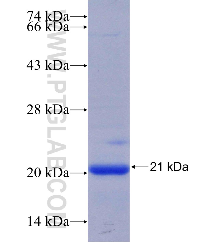 TMC4 fusion protein Ag28110 SDS-PAGE
