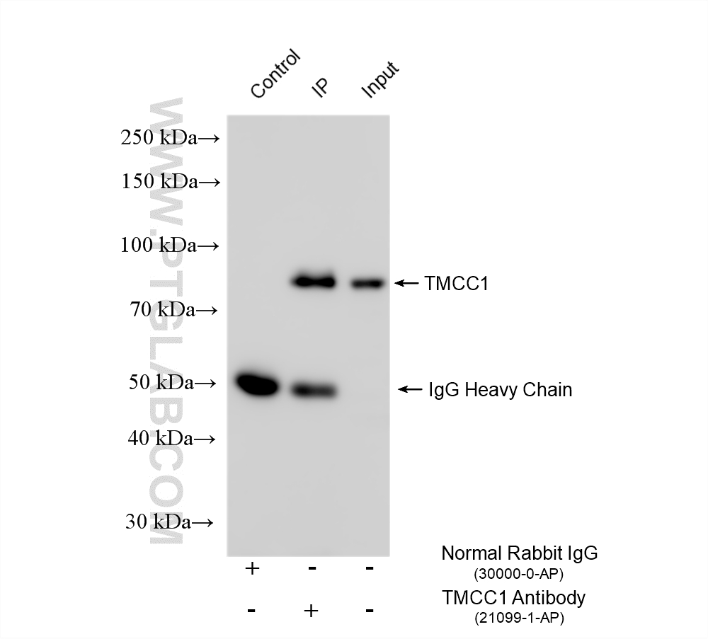 IP result of anti-TMCC1 (IP:21099-1-AP, 4ug; Detection:21099-1-AP 1:2000) with MCF-7 cells lysate 1400 ug. IP experiment of MCF-7 using 21099-1-AP