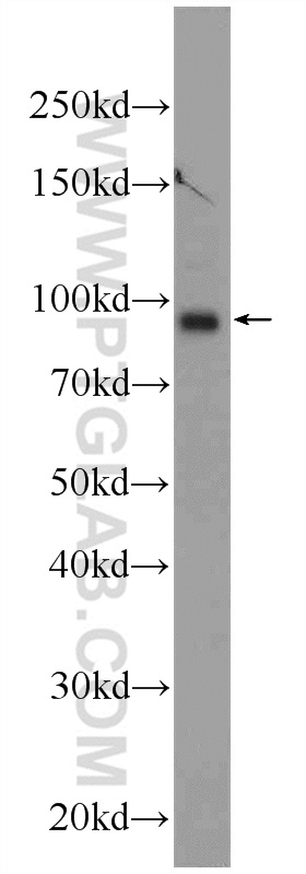 WB analysis of mouse brain using 25042-1-AP