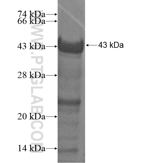 TMCC2 fusion protein Ag19918 SDS-PAGE TMCC2 fusion protein Ag19918 SDS-PAGE