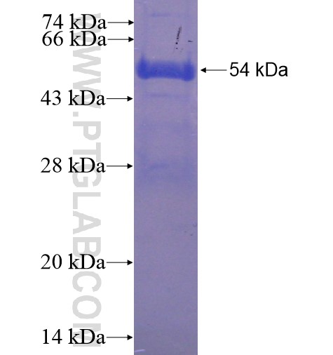 TMCO5A fusion protein Ag15032 SDS-PAGE TMCO5A fusion protein Ag15032 SDS-PAGE