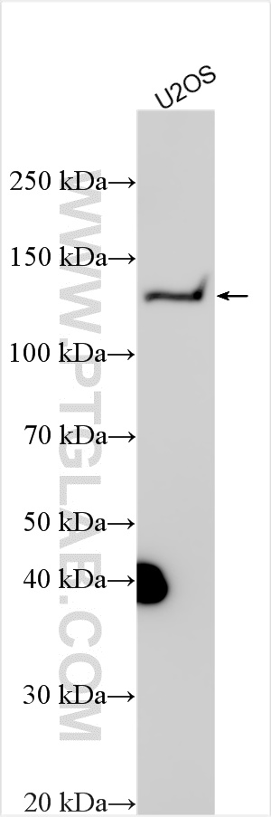 WB analysis using 32692-1-AP