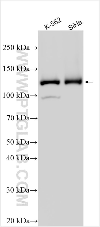 WB analysis using 32692-1-AP