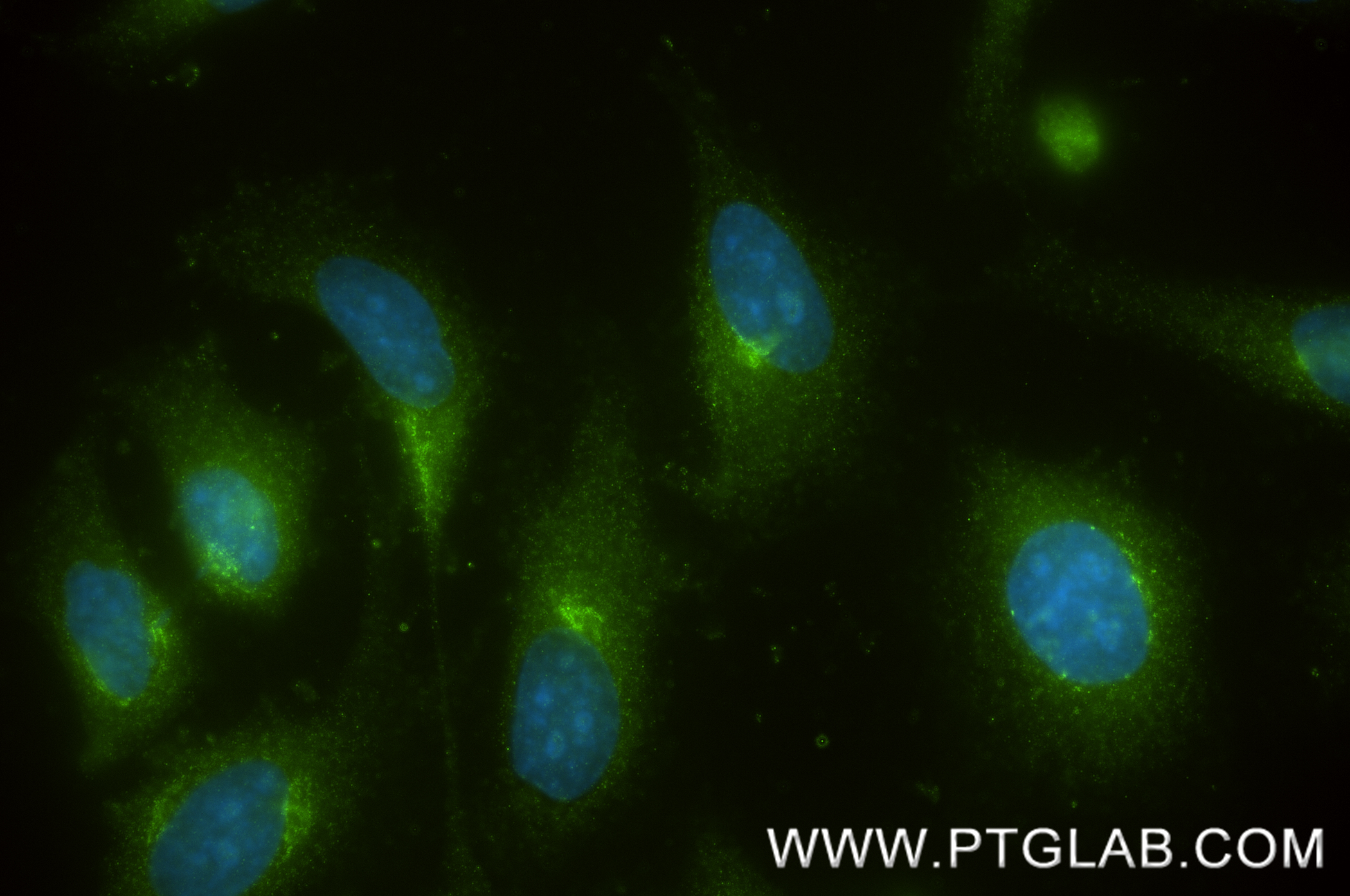 IF Staining of HeLa using 87837-1-RR