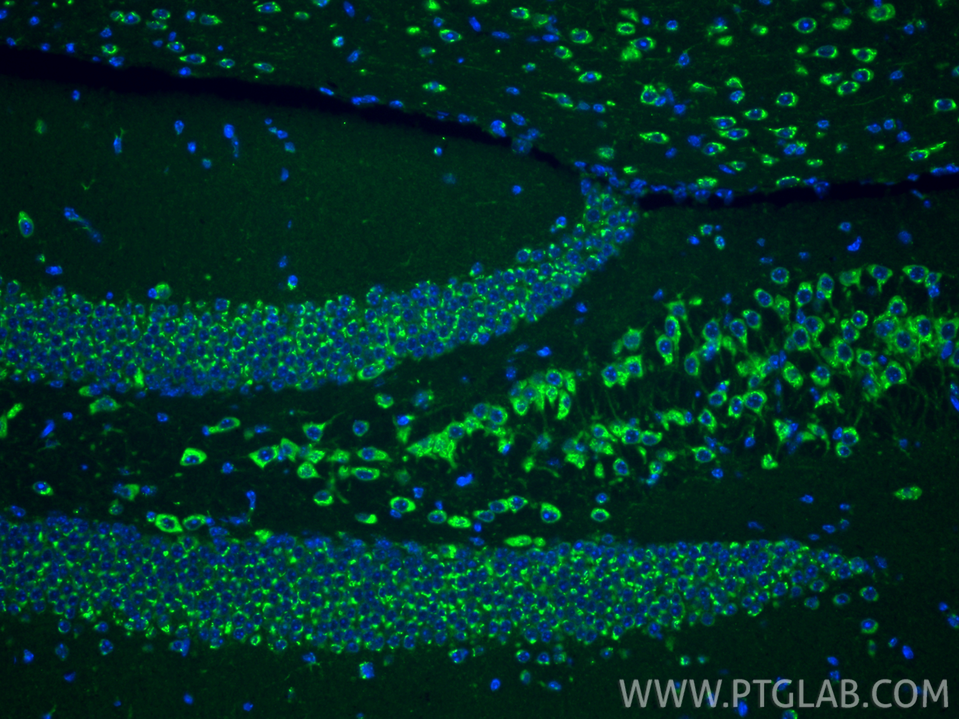 IF Staining of mouse brain using 15199-1-AP IF Staining of mouse brain using 15199-1-AP