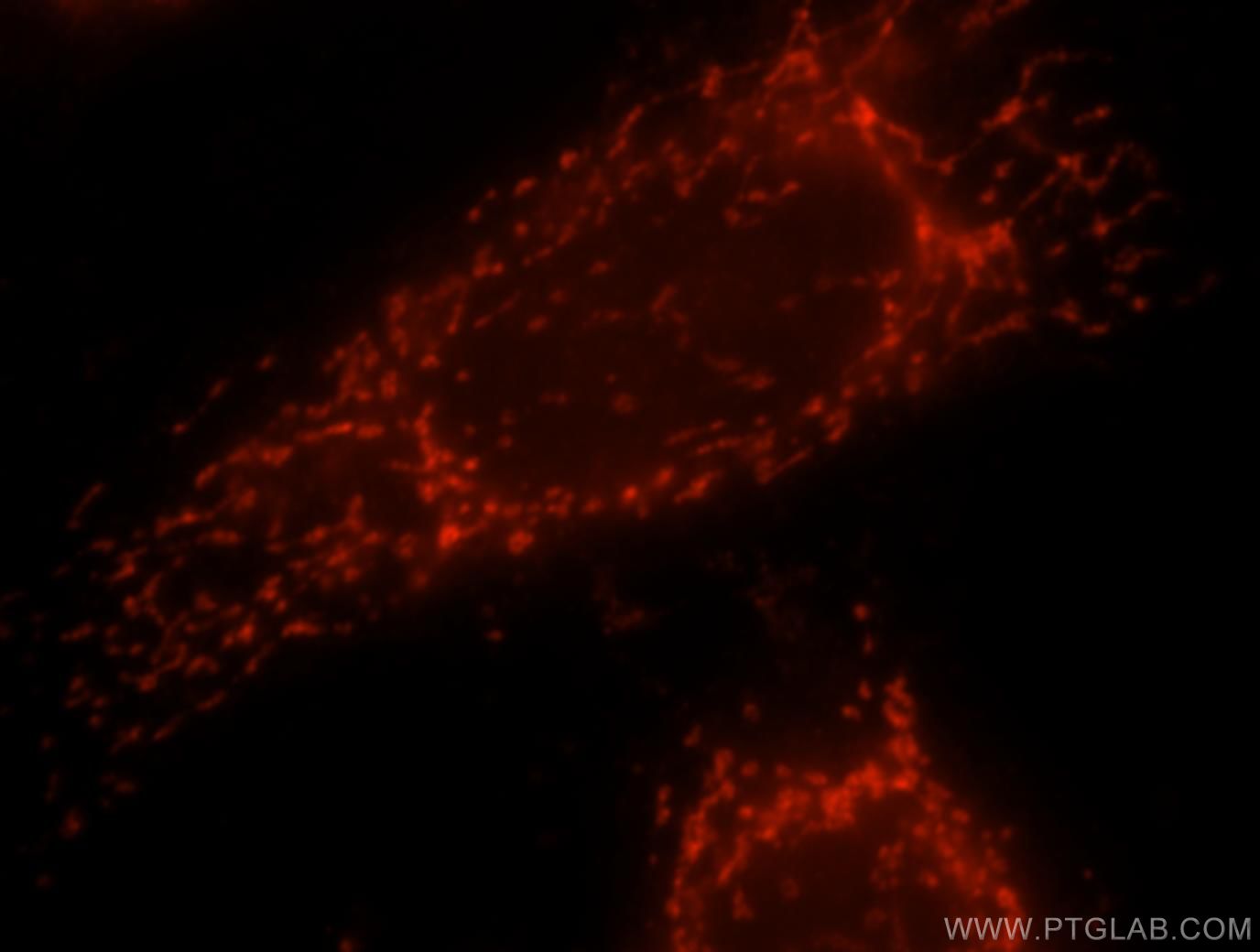 IF Staining of HeLa using 15199-1-AP