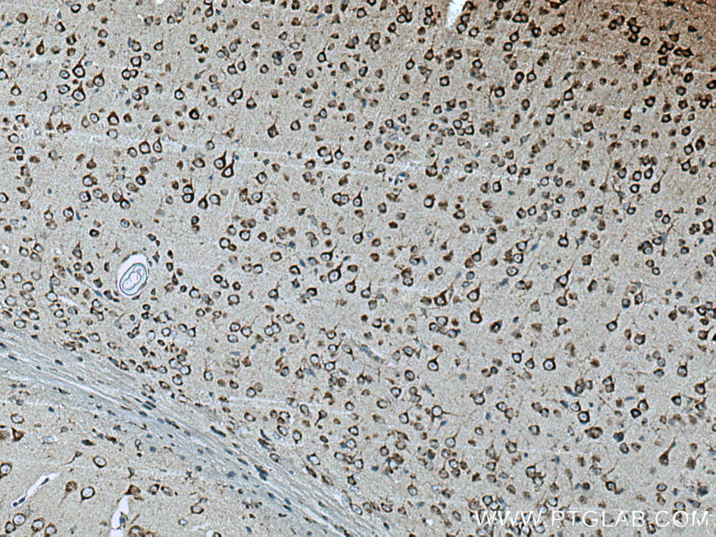 IHC staining of mouse brain using 15199-1-AP