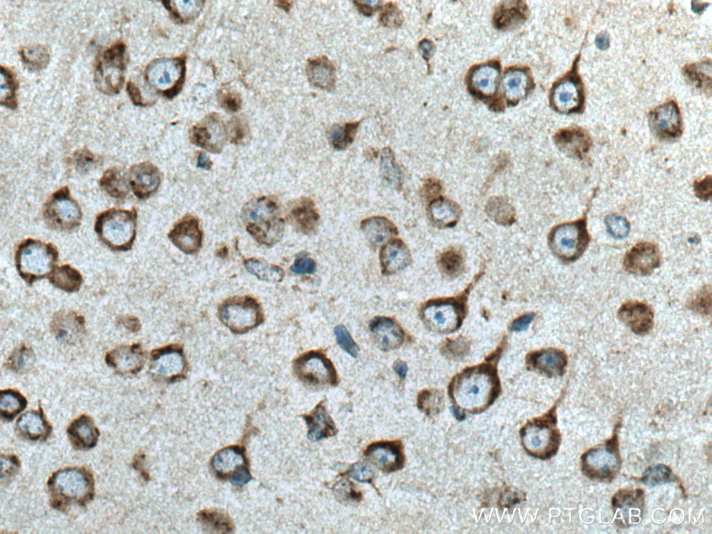 IHC staining of mouse brain using 15199-1-AP