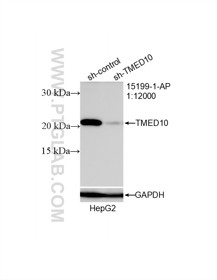 WB analysis of HepG2 using 15199-1-AP WB analysis of HepG2 using 15199-1-AP