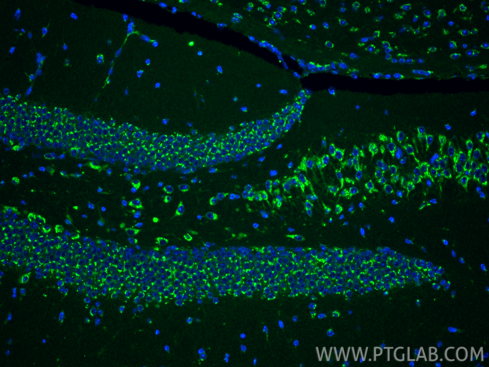 IF Staining of mouse brain using 67876-1-Ig IF Staining of mouse brain using 67876-1-Ig