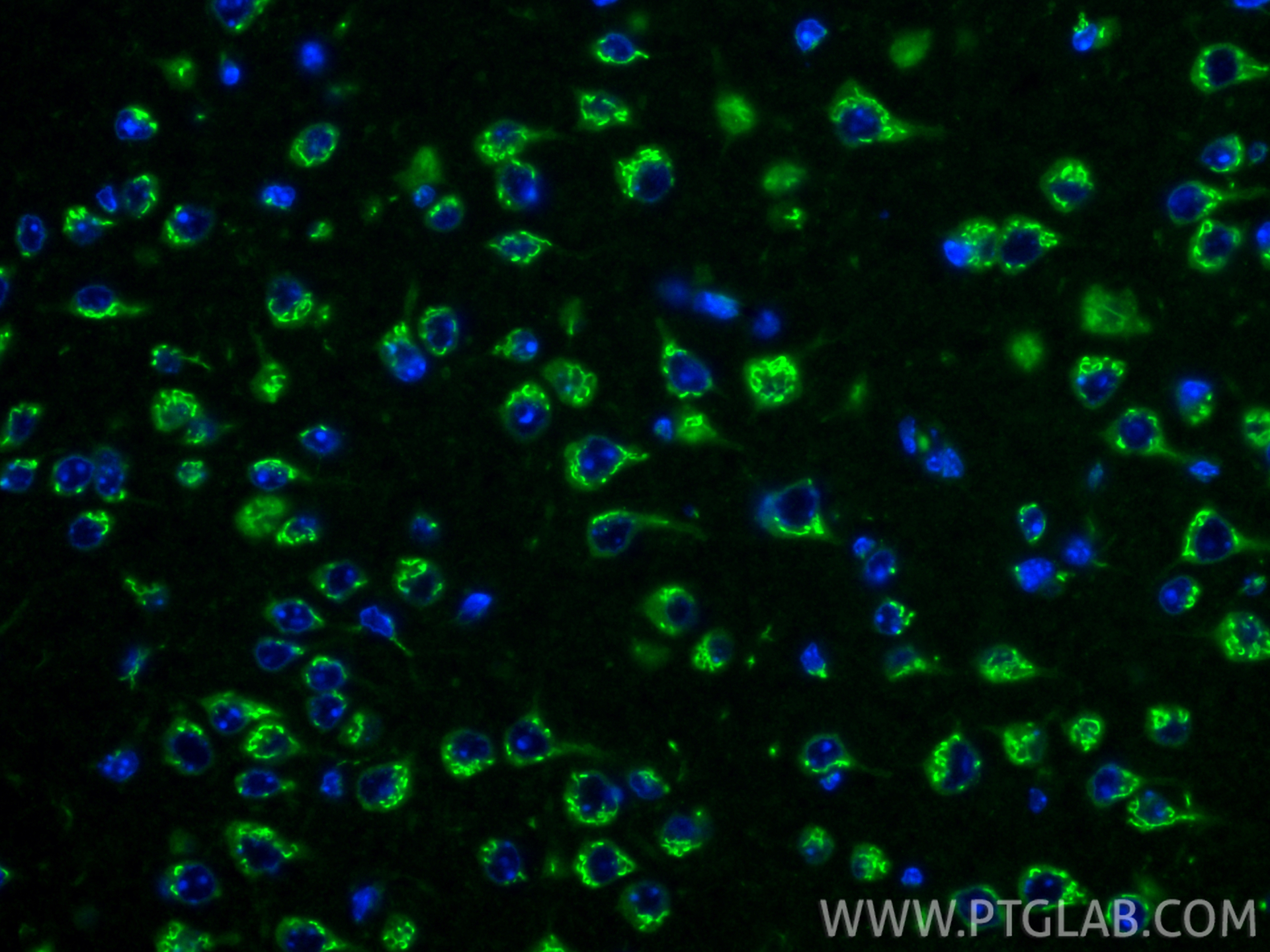 IF Staining of mouse brain using 67876-1-Ig IF Staining of mouse brain using 67876-1-Ig
