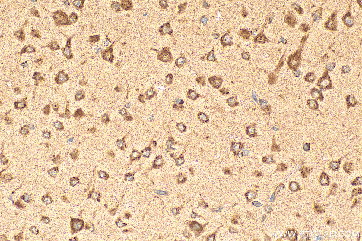 Immunohistochemical analysis of paraffin-embedded mouse brain tissue slide using 11981-1-AP (TMED2 antibody) at dilution of 1:1000 (under 40x lens). Heat mediated antigen retrieval with Tris-EDTA buffer (pH 9.0). IHC staining of mouse brain using 11981-1-AP