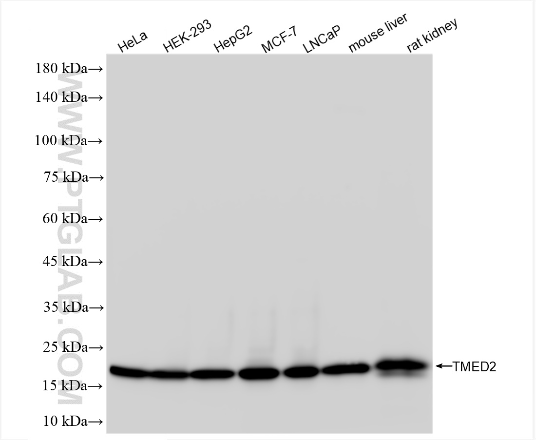 WB analysis using 86172-1-RR