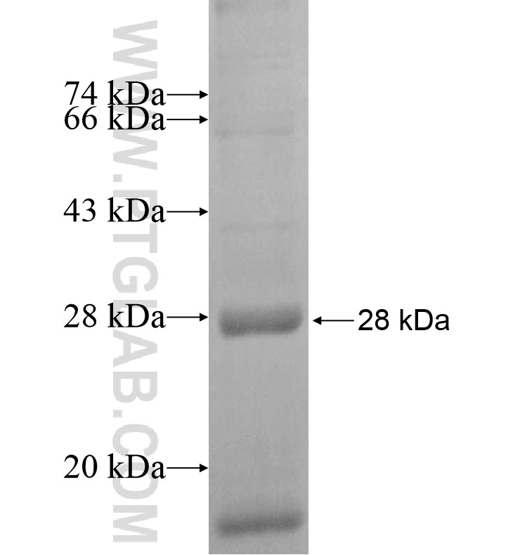 TMED2 fusion protein Ag16945 SDS-PAGE TMED2 fusion protein Ag16945 SDS-PAGE