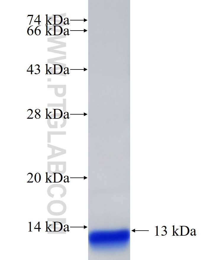 TMED5 fusion protein Ag33265 SDS-PAGE TMED5 fusion protein Ag33265 SDS-PAGE