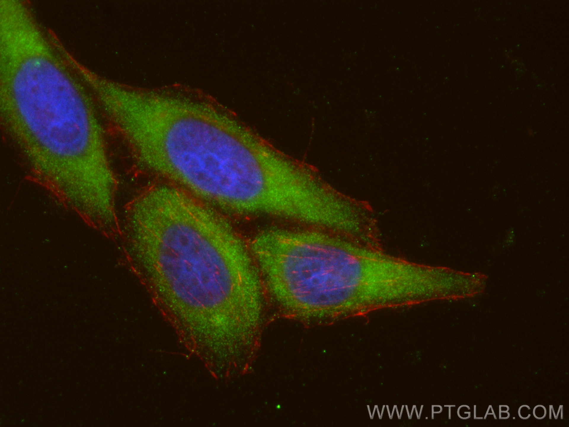 IF Staining of HepG2 using 21620-1-AP