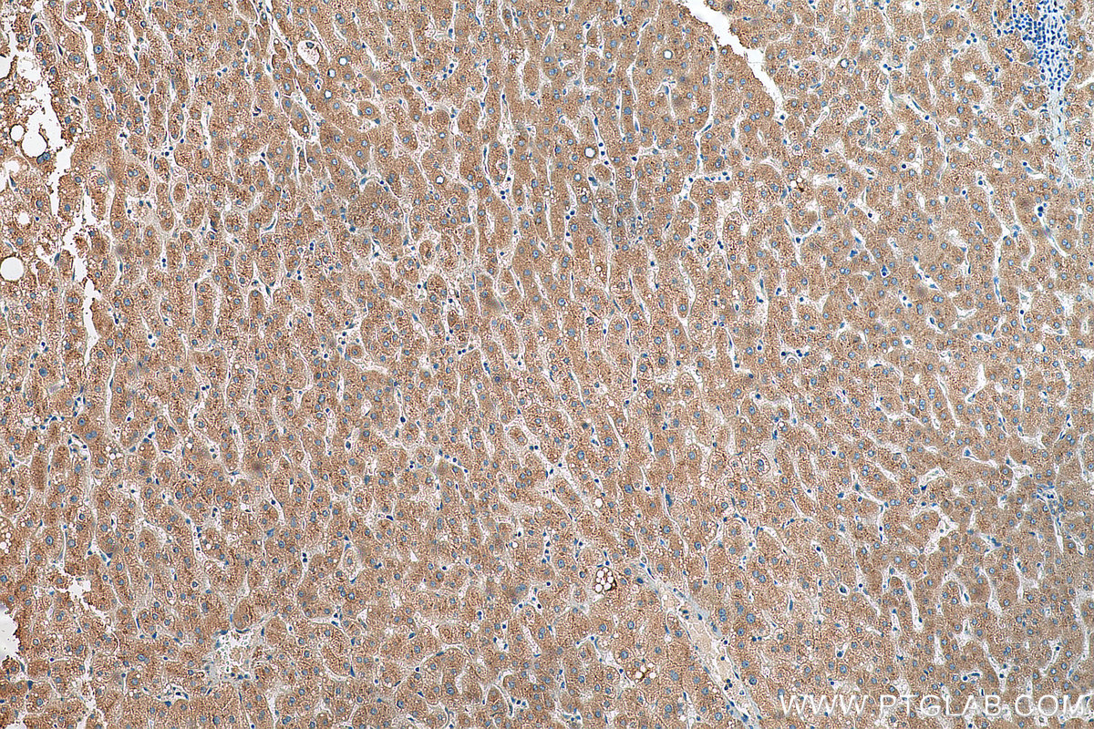 IHC staining of human liver using 21620-1-AP