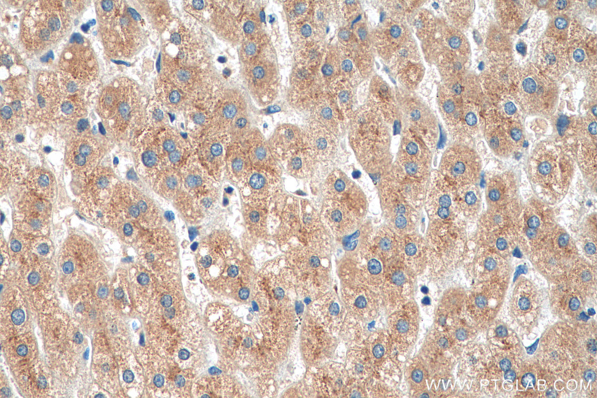 IHC staining of human liver using 21620-1-AP