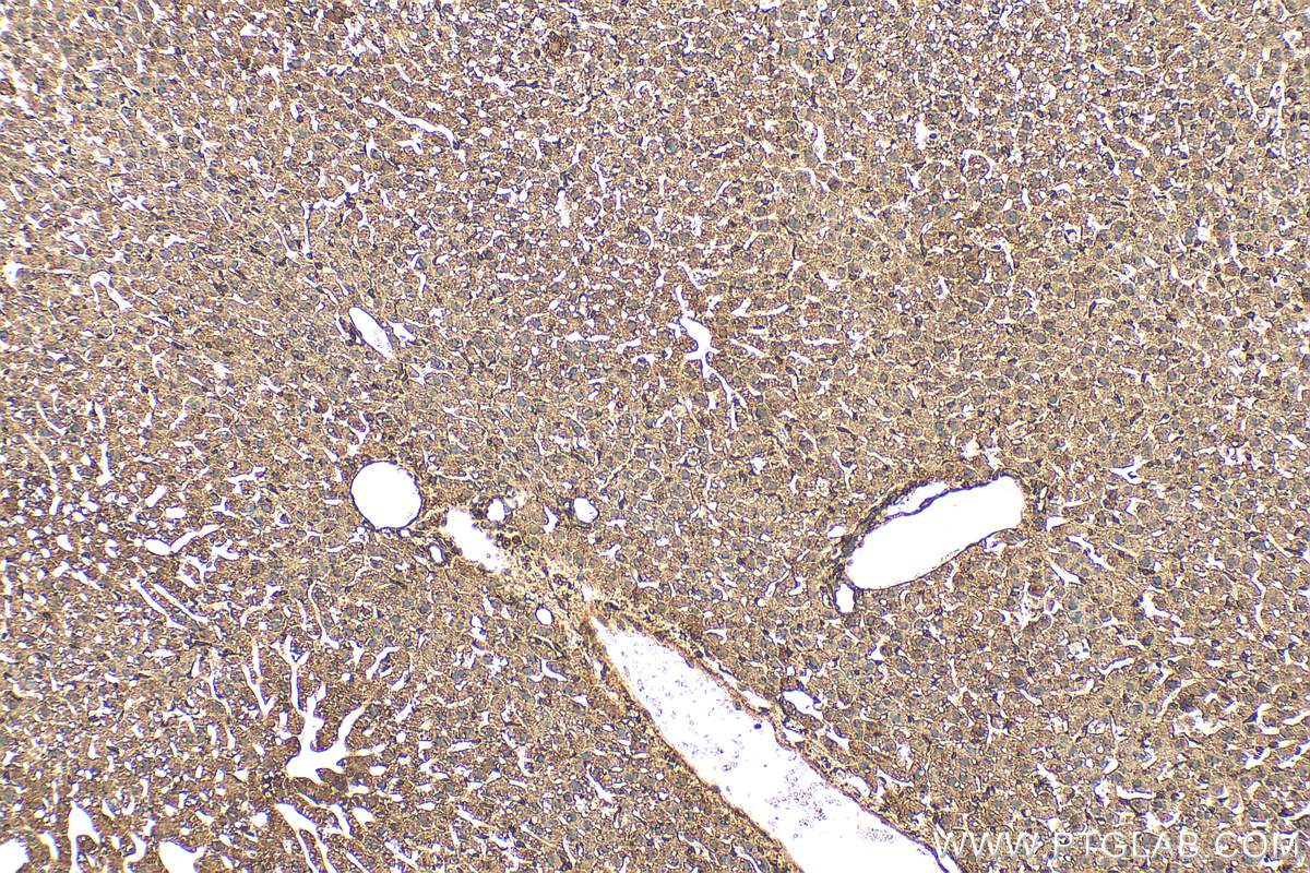 IHC staining of mouse liver using 60631-7-Ig