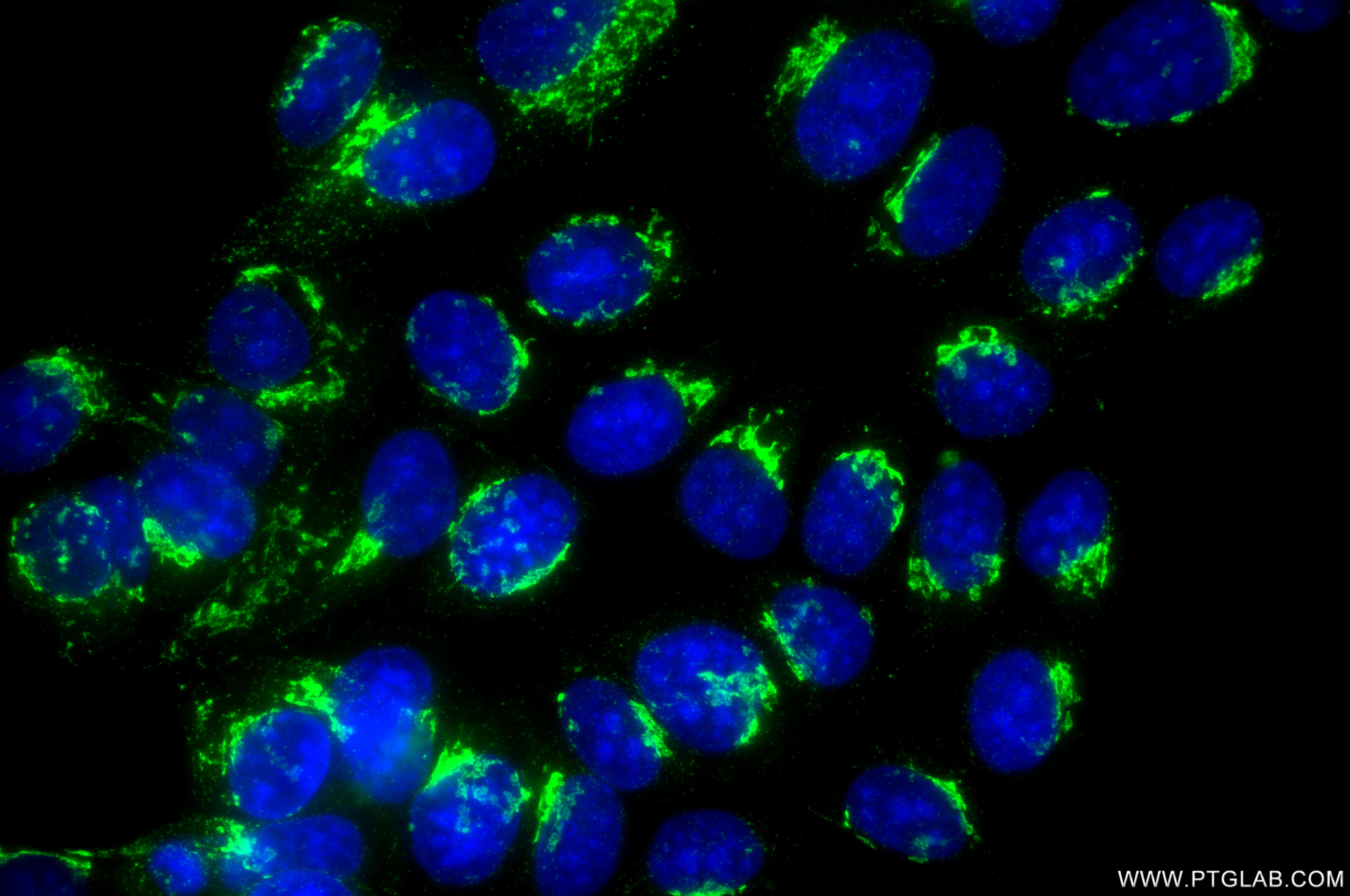 IF Staining of MCF-7 using 86802-1-RR