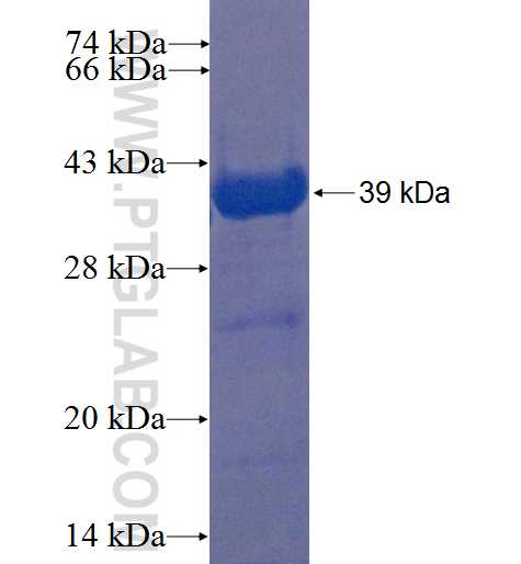 TMEM102 fusion protein Ag22398 SDS-PAGE TMEM102 fusion protein Ag22398 SDS-PAGE