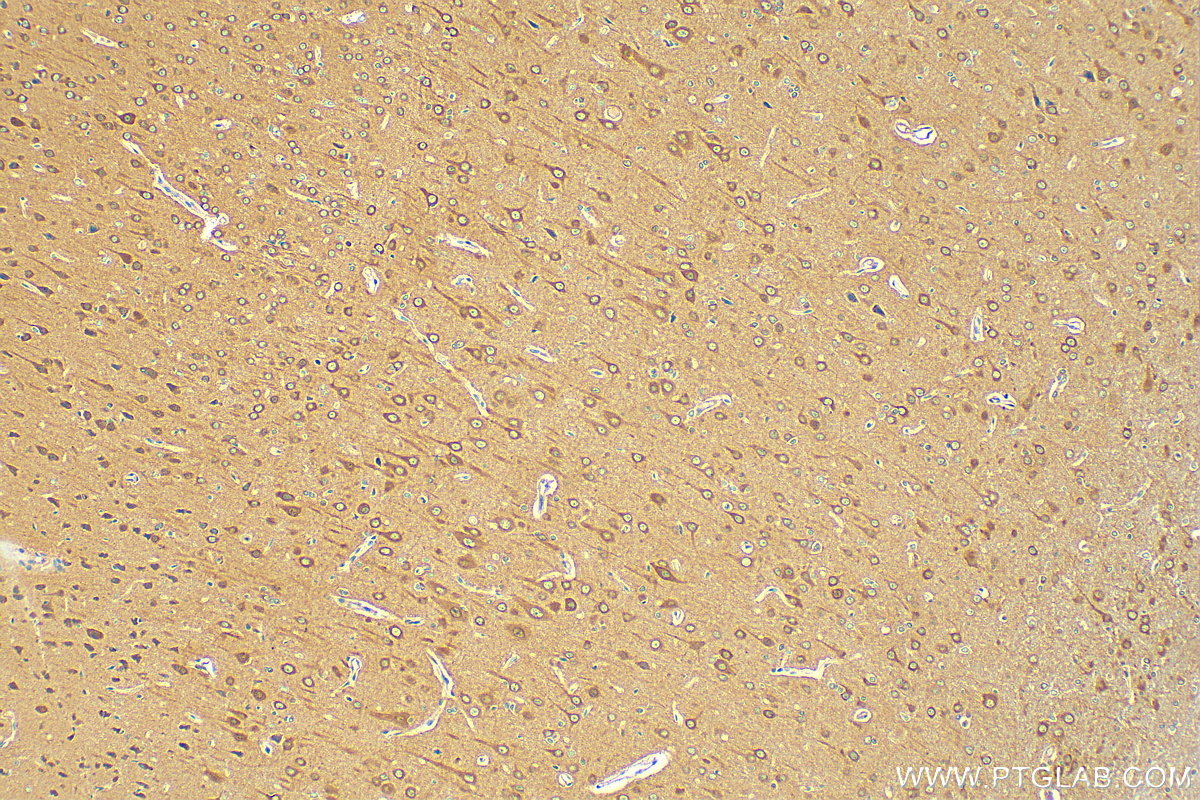 IHC staining of rat brain using 20995-1-AP