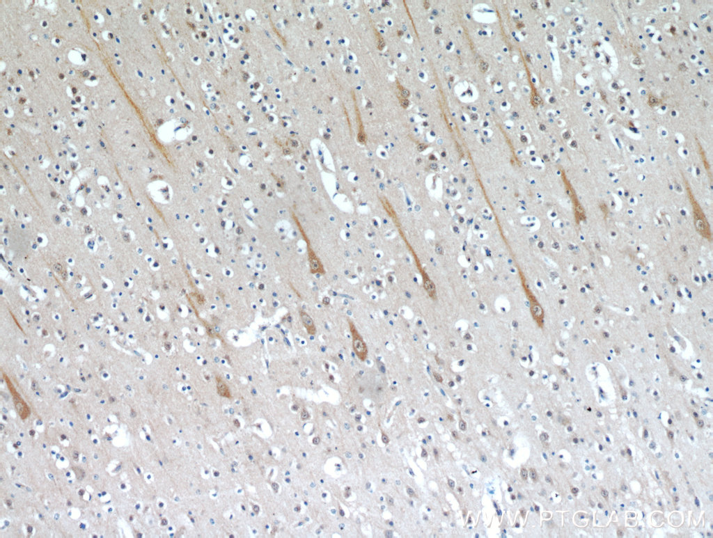 TMEM106B Polyclonal antibody