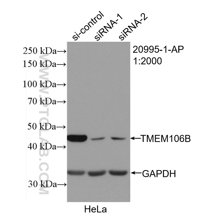 WB analysis of HeLa using 20995-1-AP