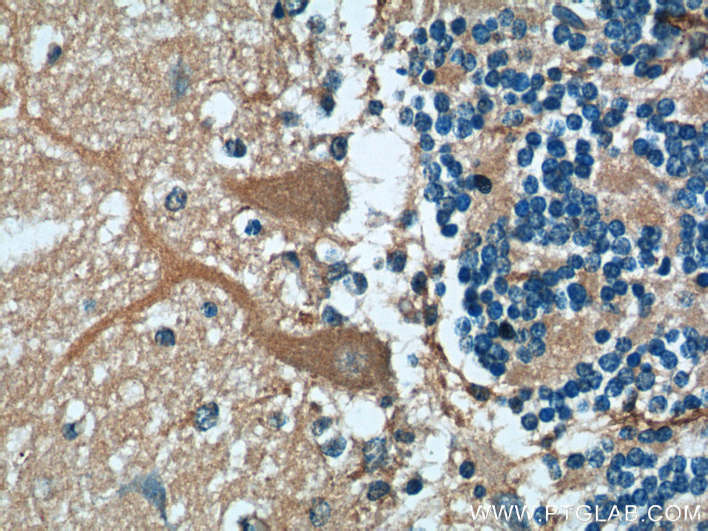 TMEM106B (1-46aa)