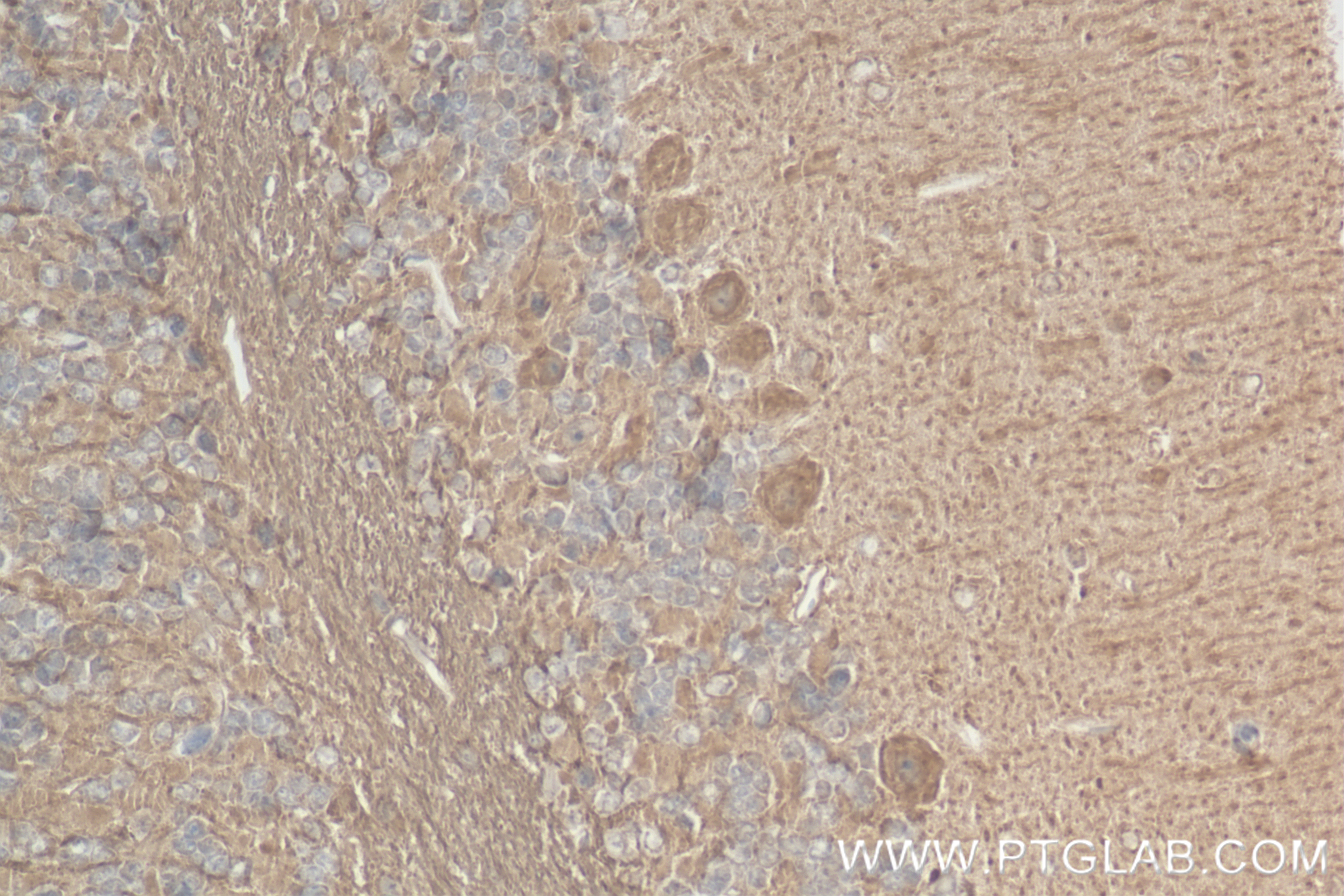 IHC staining of mouse cerebellum using 84196-2-RR (same clone as 84196-2-PBS)