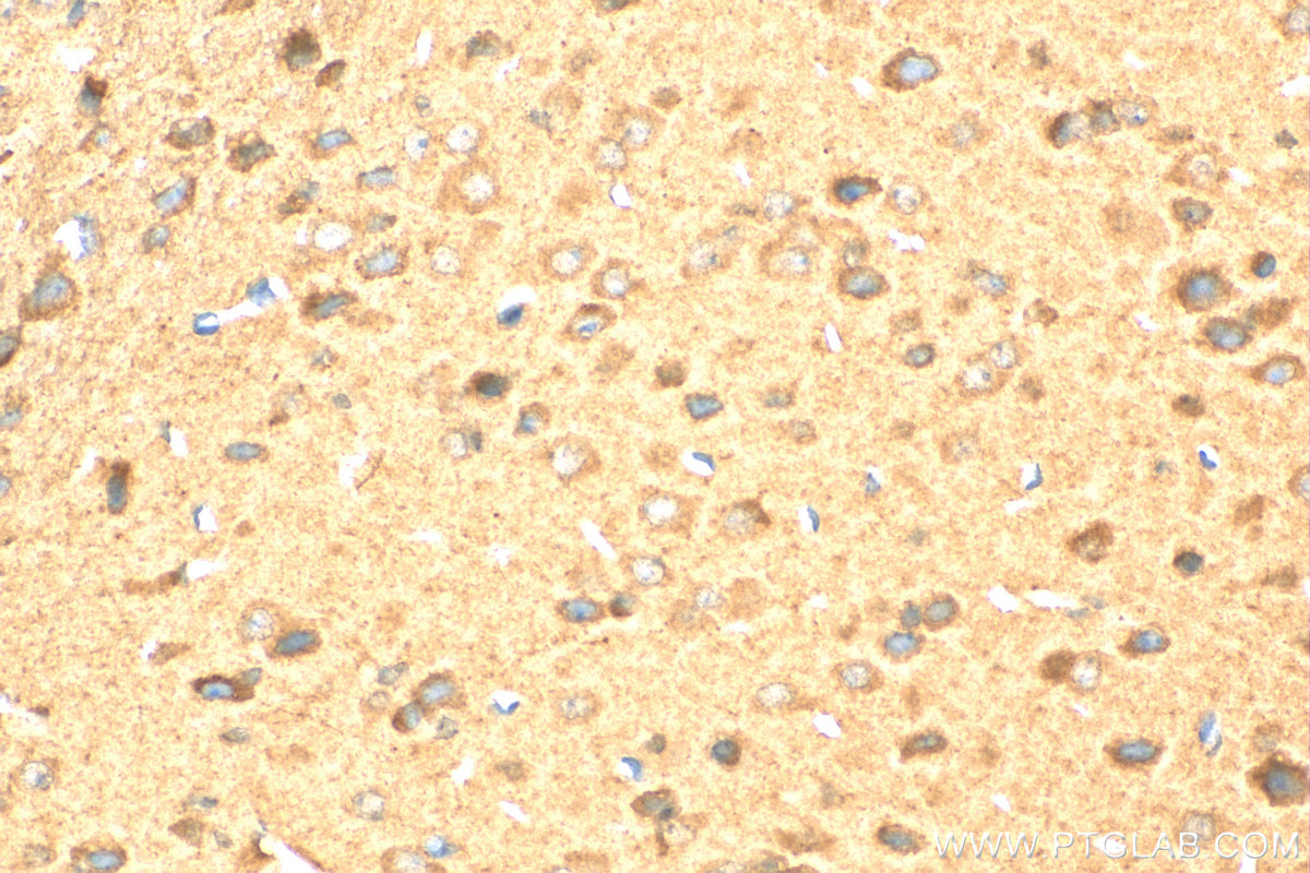IHC staining of mouse brain using 15177-1-AP