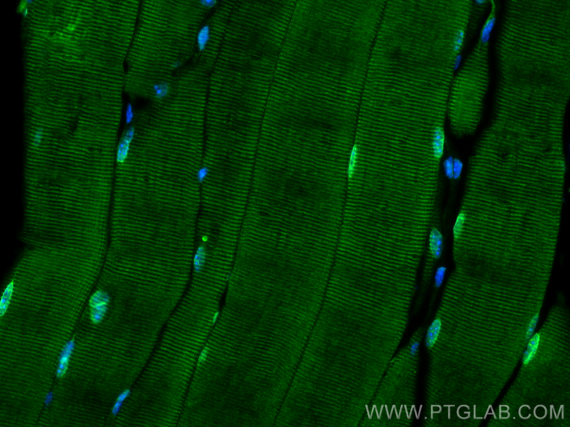 IF Staining of mouse skeletal muscle using 31438-1-AP