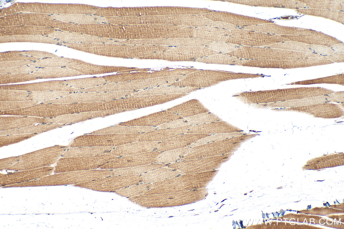IHC staining of mouse skeletal muscle using 31438-1-AP