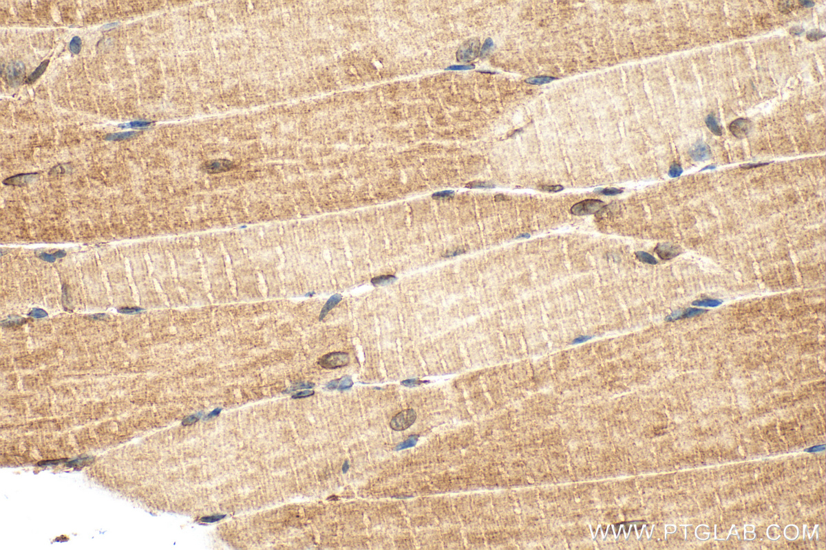 IHC staining of mouse skeletal muscle using 31438-1-AP