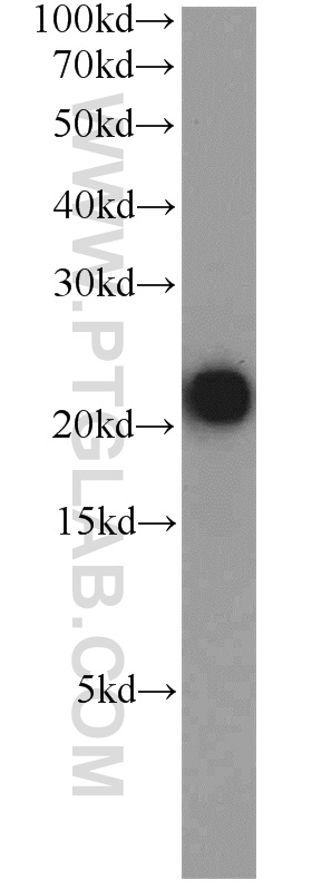 WB analysis of human placenta using 16564-1-AP