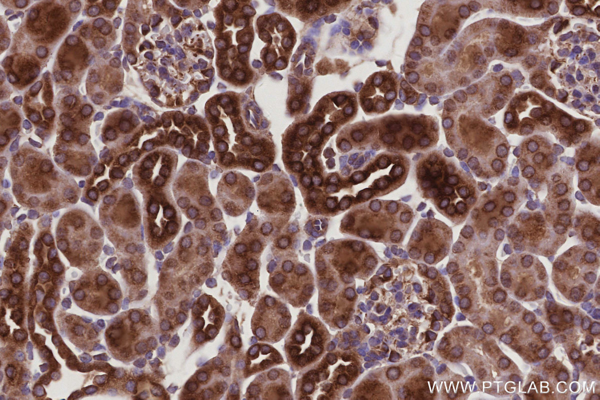 IHC staining of mouse kidney using 67205-1-Ig