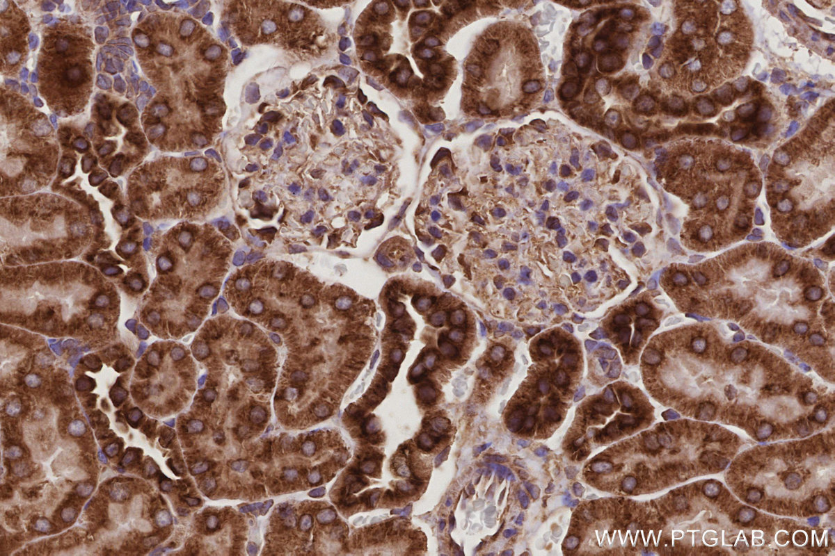 IHC staining of rat kidney using 67205-1-Ig