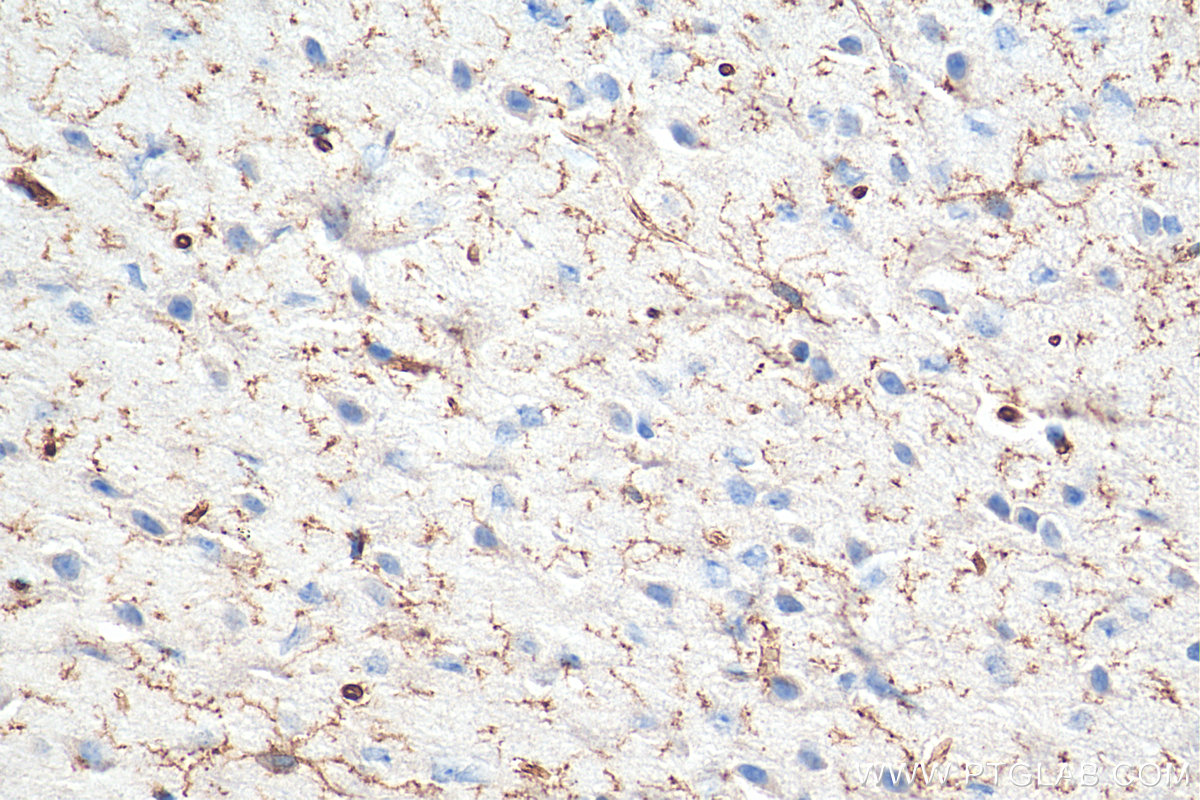 IHC staining of mouse brain using 27585-1-AP