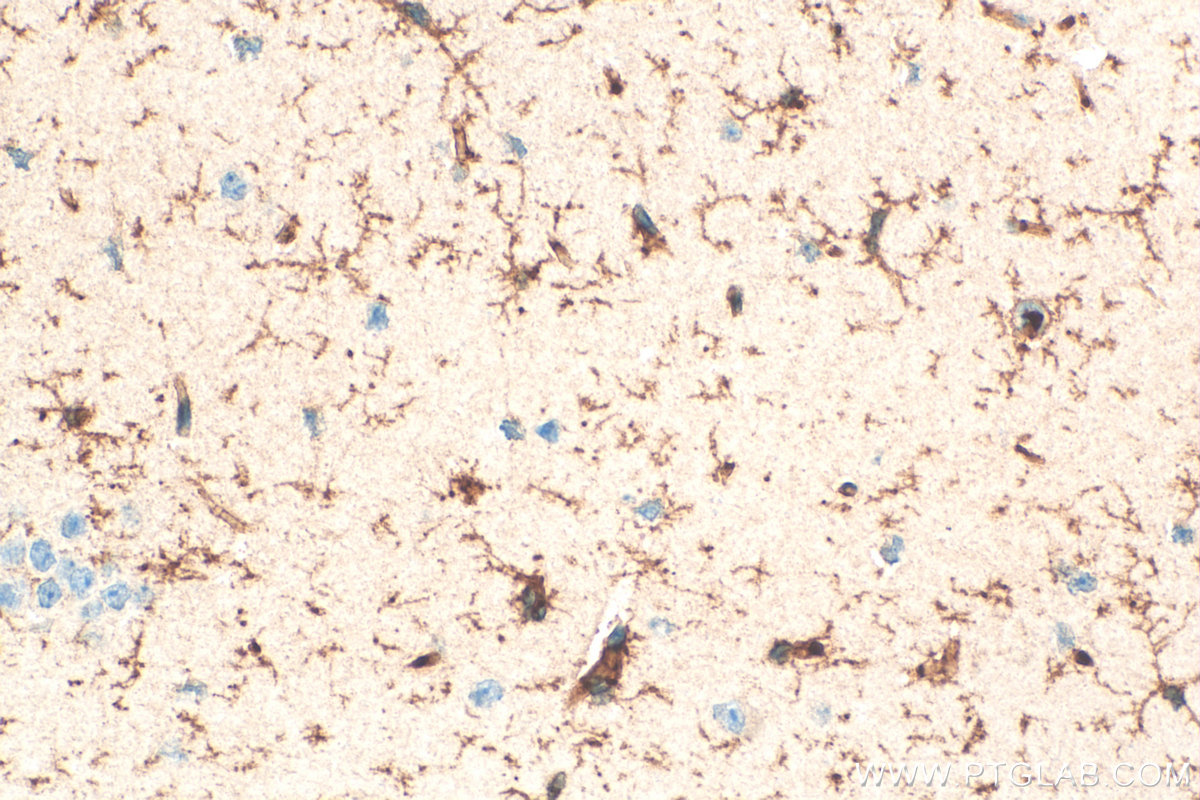 IHC staining of mouse brain using 27585-1-AP (same clone as 27585-1-PBS)