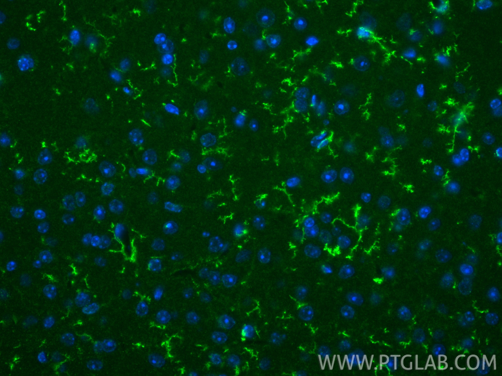 IF Staining of mouse brain using 83448-9-RR IF Staining of mouse brain using 83448-9-RR