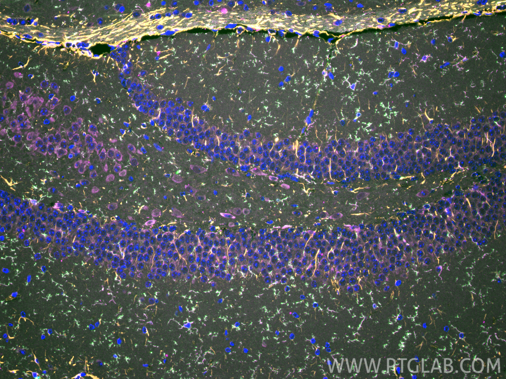 IF Staining of mouse brain using 83448-9-RR IF Staining of mouse brain using 83448-9-RR