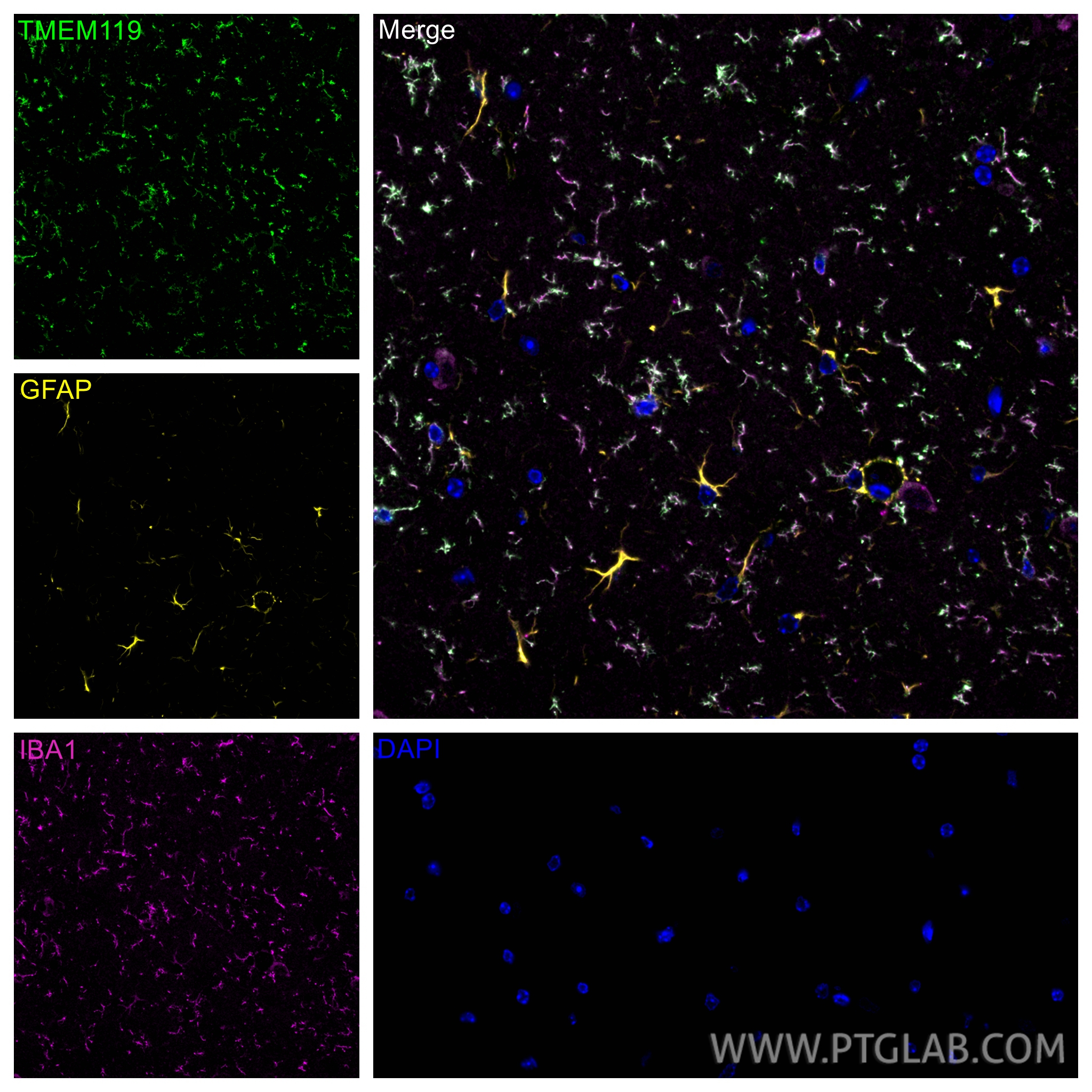 IF Staining of mouse brain using 83448-9-RR IF Staining of mouse brain using 83448-9-RR