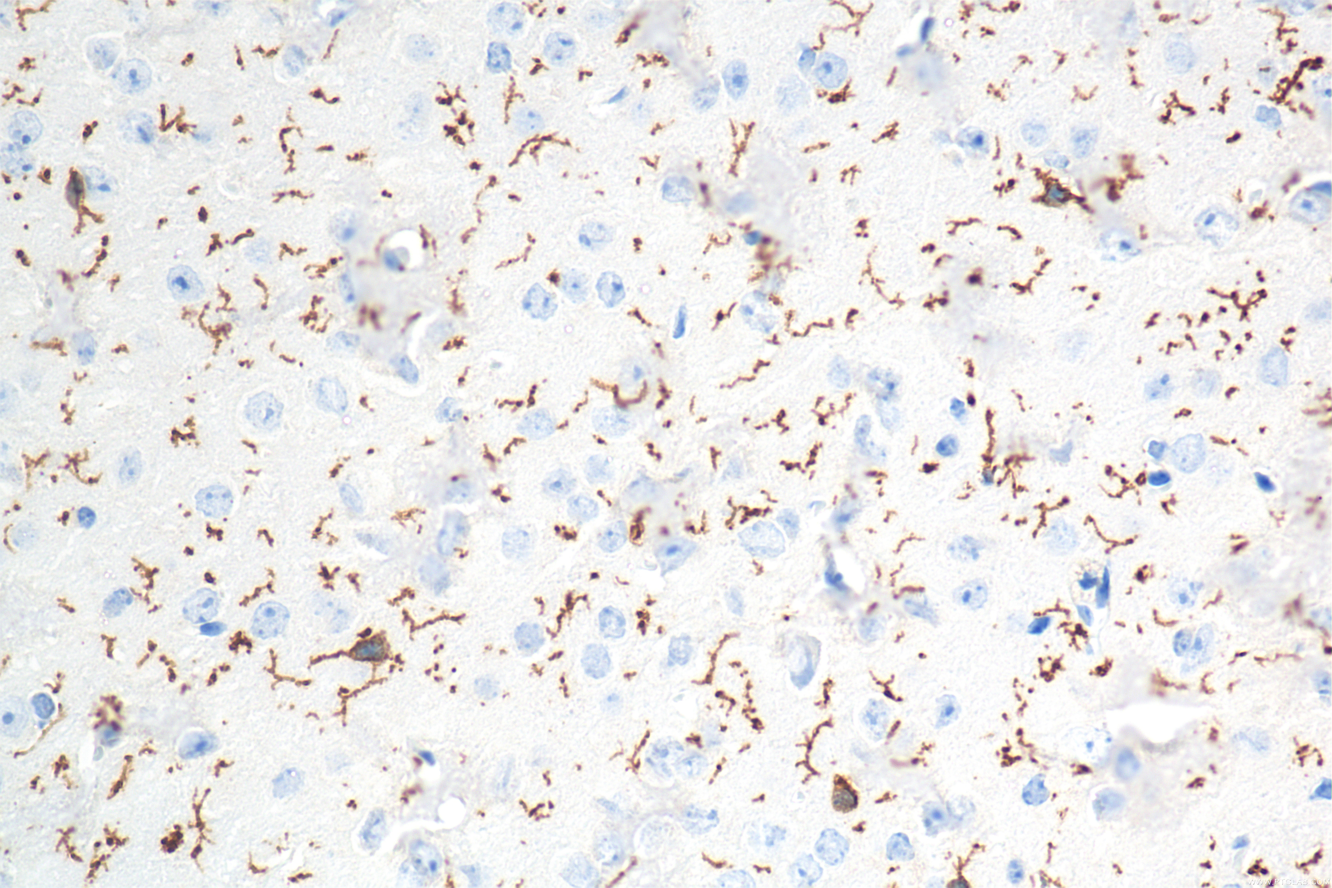 IHC staining of mouse brain using 83448-9-RR IHC staining of mouse brain using 83448-9-RR