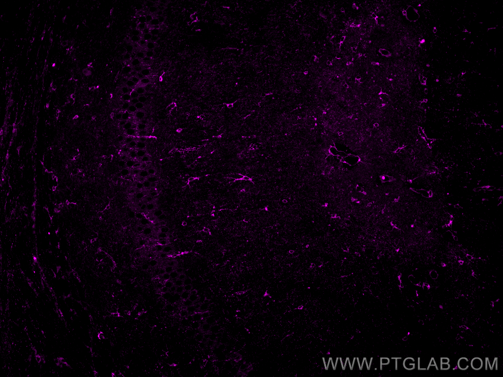 IF Staining of mouse brain using CL647-27585