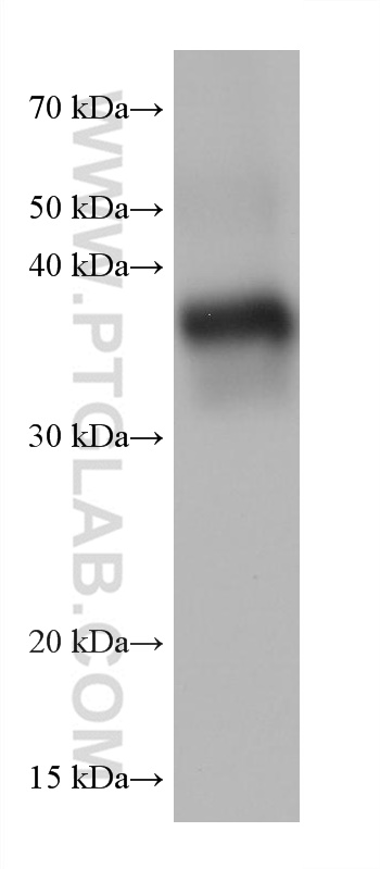WB analysis of mouse liver using 68229-1-Ig (same clone as 68229-1-PBS)