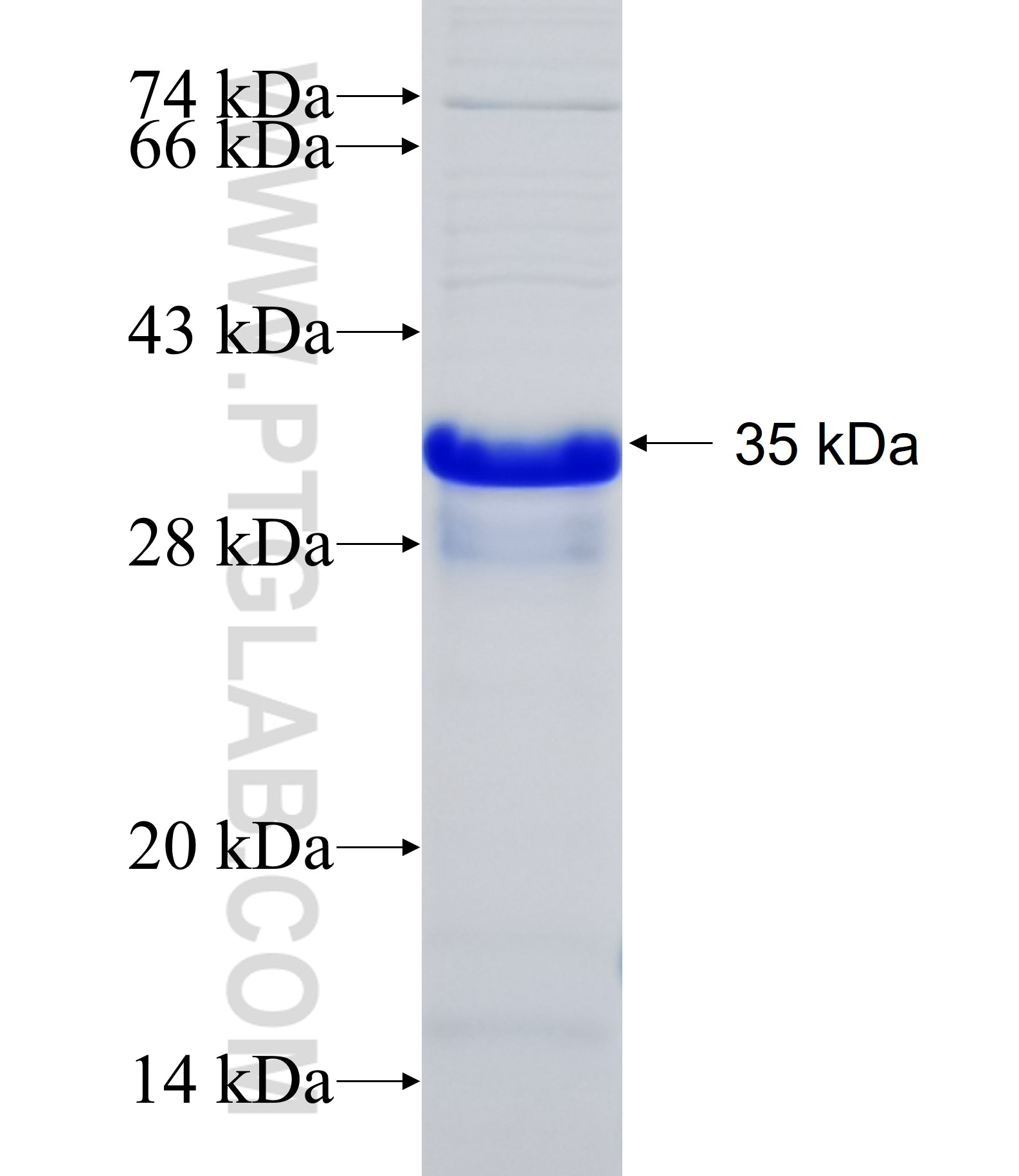 TMEM123 fusion protein Ag26035 SDS-PAGE TMEM123 fusion protein Ag26035 SDS-PAGE